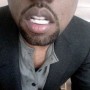 Kanye West's Diamond Implants Kanye West Diamond Implants